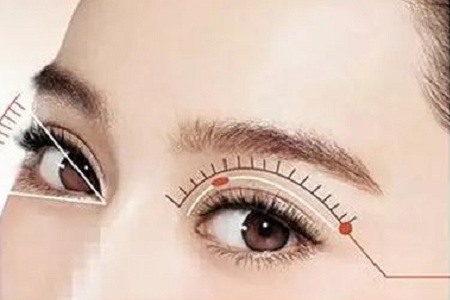 北京美莱做眼袋综合手术多少钱