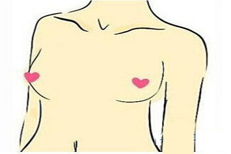 隆胸整形手术